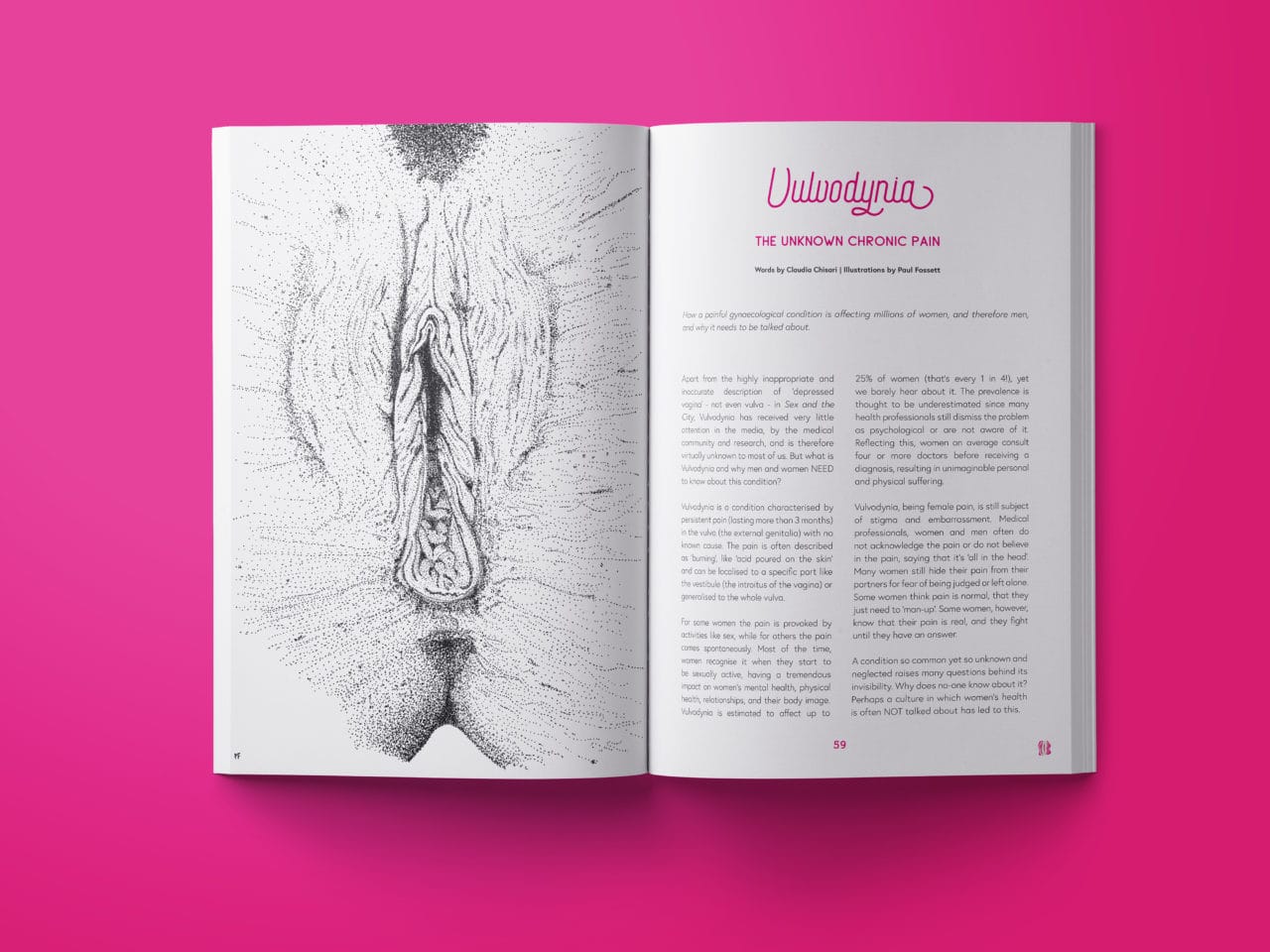 Some pages of Vagina-nomics about Vulvodynia, on the left page there is a black and white drawing of a vulva and on the right there is text.
